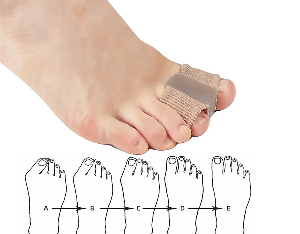 TOECARE - Bunion Support